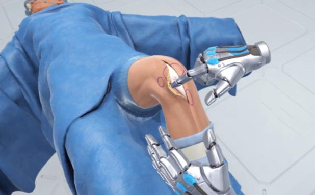 Ghost Productions Wraith VR Total Knee Replacement Surgery Simulation Torrent Download